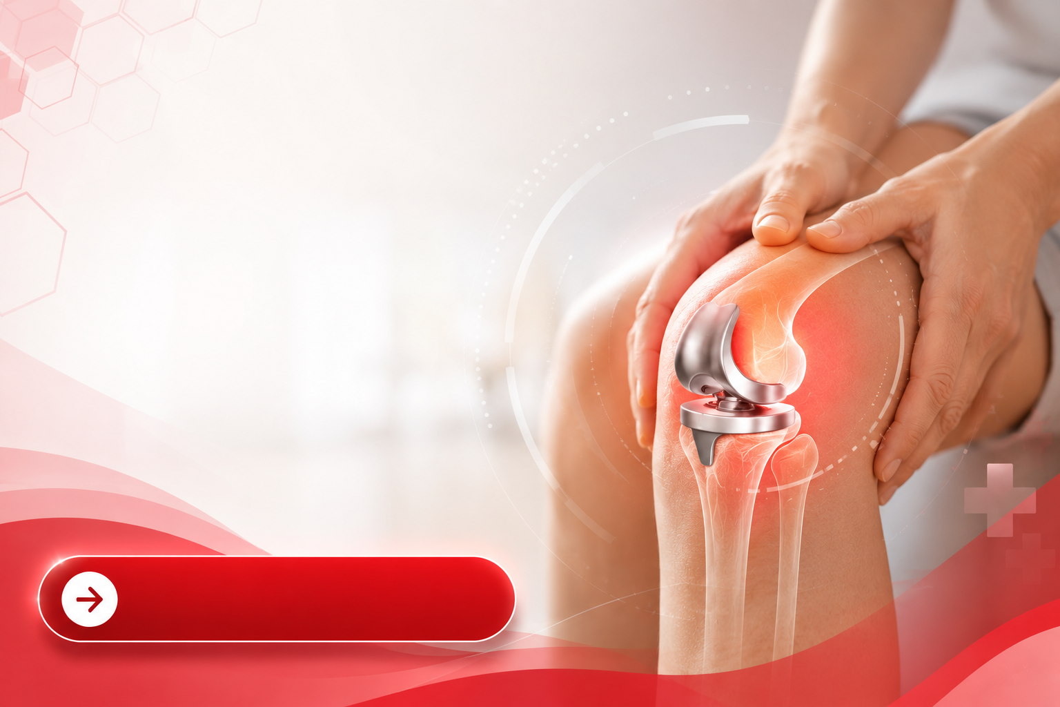 Do You Really Need Knee Replacement? Questions to Discuss With Your Doctor