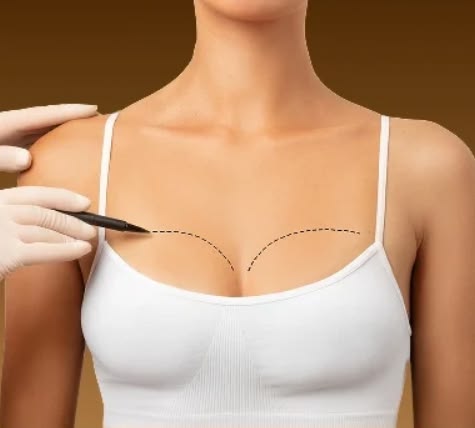 Breast Surgery Tips – Explore Preparation & Recovery Information